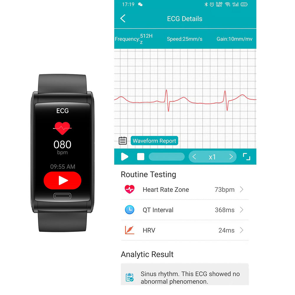 HealthGuard - Advanced Health Bracelet - 3-Channel ECG, Blood Sugar & Oxygen Monitoring for Complete Wellness